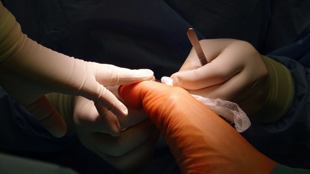 Sorgfältige podologische Behandlung im Detail