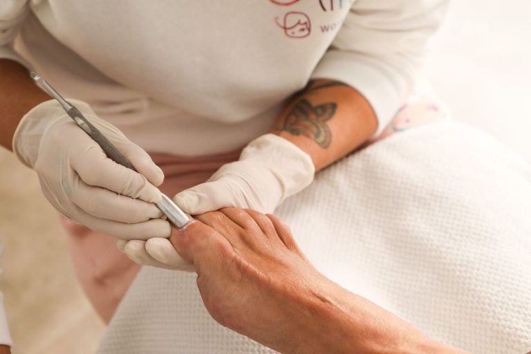Feine Instrumentenbehandlung eines eingewachsenen Zehennagels
